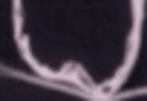 ezgif-3-88aa0fafdf.gif