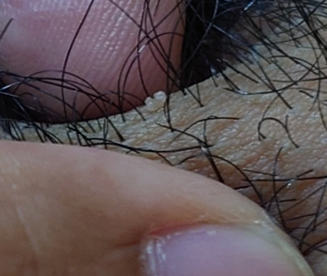 1710695341158.png